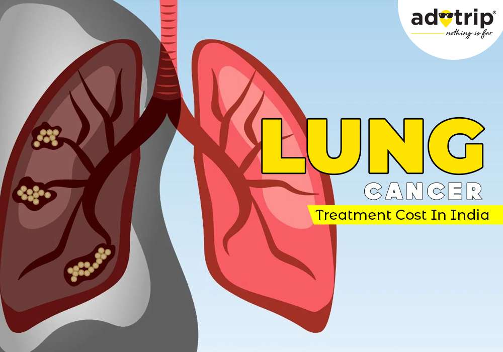 lung cancer treatment cost in india